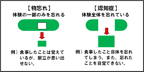 物忘れと認知症の違い（画像）